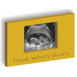 My First Picture - rámeček na fotku z ultrazvuku - žlutý - 1 ks